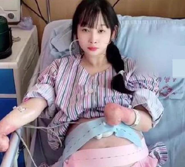 丈夫回应无手女孩怀孕遭恶评