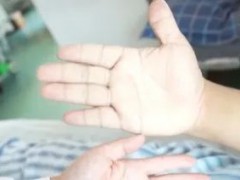 男子突然变丑 下唇比上唇厚一倍 竟是垂体瘤作祟