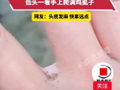 女子鸡圈抓鸡浑身痒疼，低头一看手上爬满鸡虱子