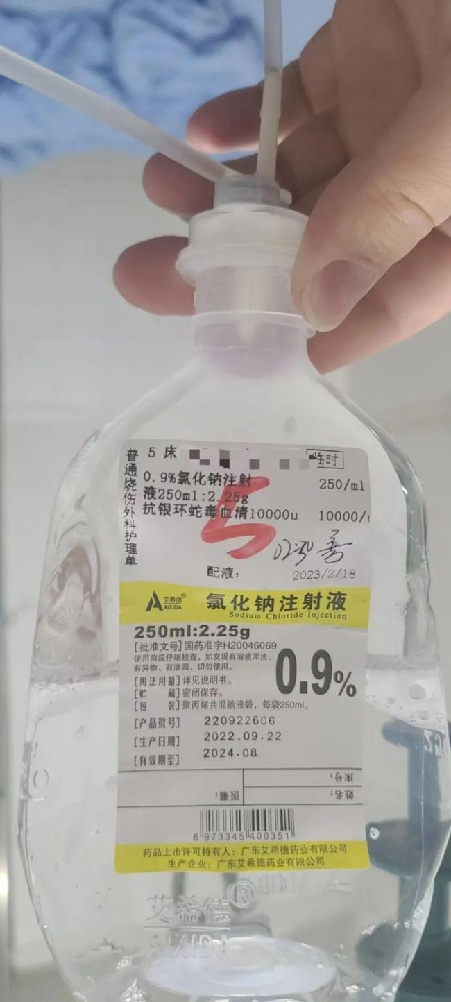 女子被蛇咬伤两年仍有后遗症 康复之路漫长艰难
