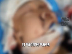 18岁少年下班途中被气枪打伤头部 家属紧急求助：寻求针对枪伤的脑科专家诊断