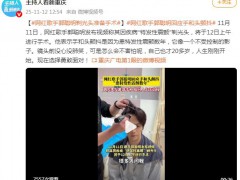 网红郭聪明剃光头发准备手术 背后真相让人惊愕！