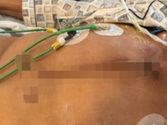 四川男子坐自家窗边玩耍遭枪击重伤 误伤事件已移交检方