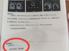 辽宁一孕妇两个月内从一胎变四胞胎 罕见同卵四胞胎引关注