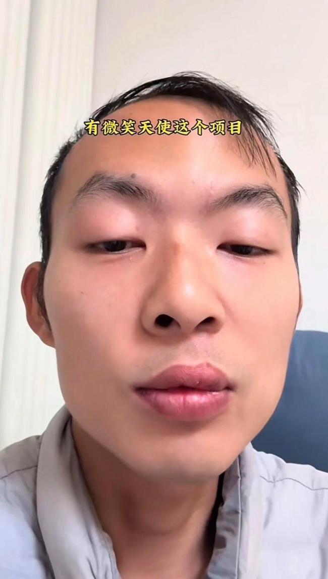 嫣然天使基金受益者发声