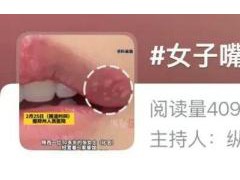 30岁女子嘴角长水疱未重视竟脑死亡 警惕疱疹风险