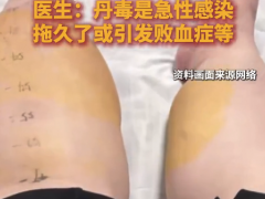 男子抠脚不洗手右腿肿成猪蹄 200斤男子爱抠脚染上丹毒
